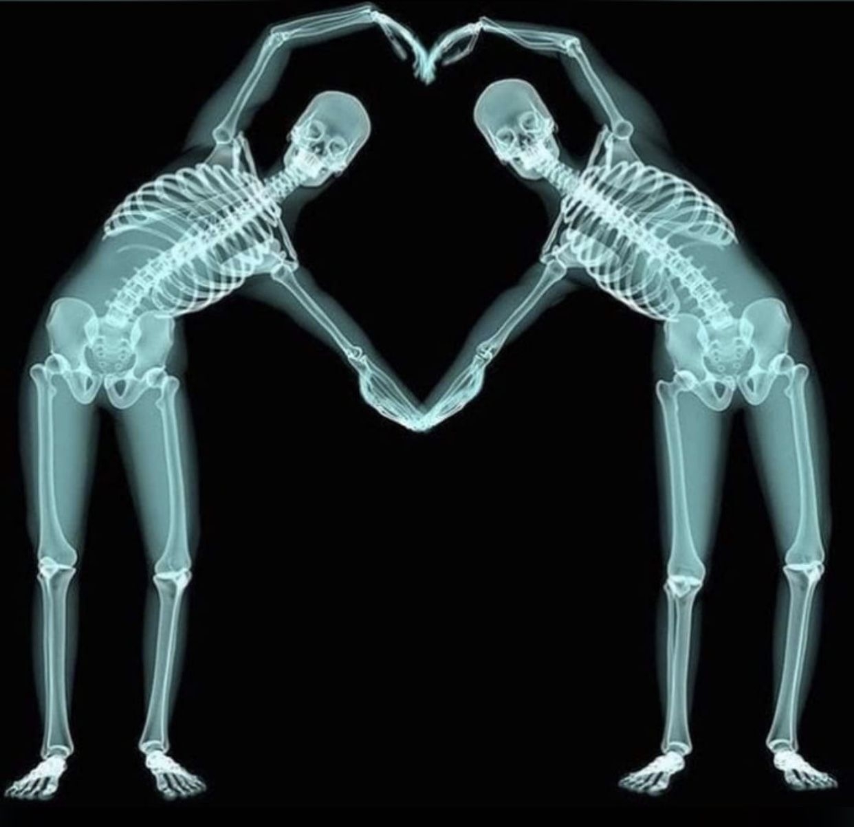 Скелеты пара. Снимок скелета. Сердце из рук скелета. Рентген человека. Прикольный рентгеновский снимок.